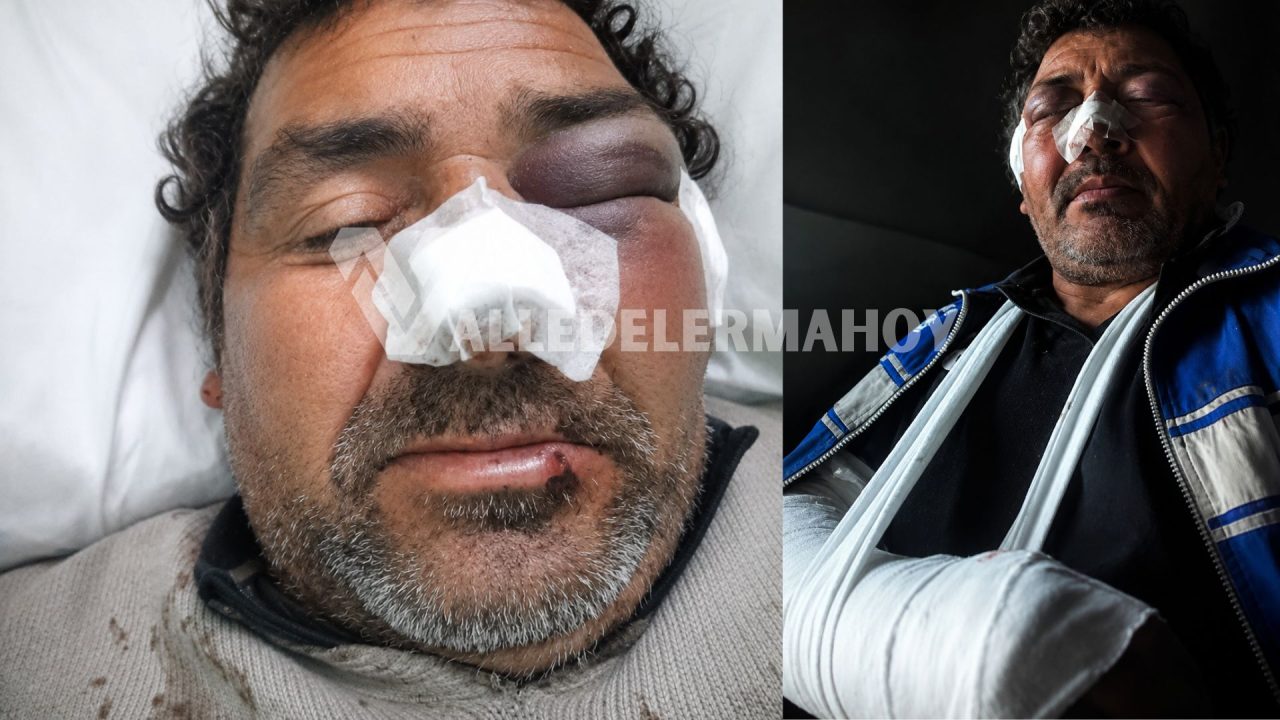 ¿Hasta cuándo?: Salvaje ataque en Barrio Costanera reaviva el reclamo por seguridad
