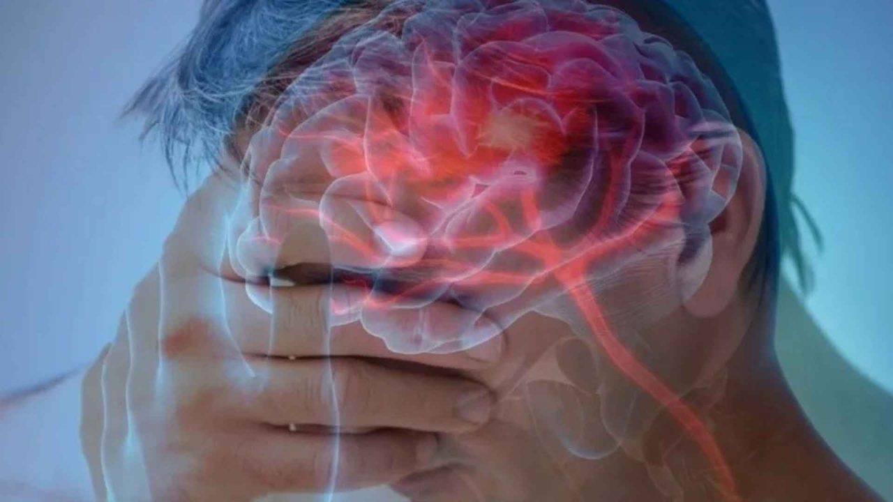 Día Mundial del ACV: El 80% de los casos son prevenibles 